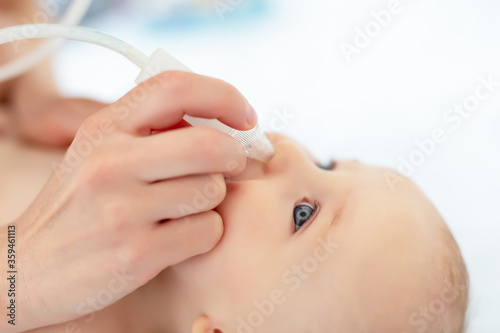 Obraz na plátně Closeup mother hand with aspirator medical tool cleaning runny nose of cute infant newborn baby boy son at home indoors