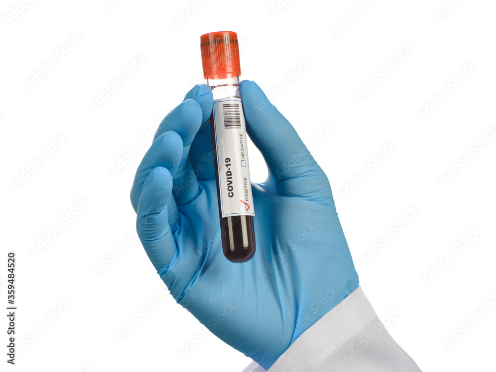 Obraz premium Blood sample tested COVID-19 positive on medical assistant's hand isolated on white background.