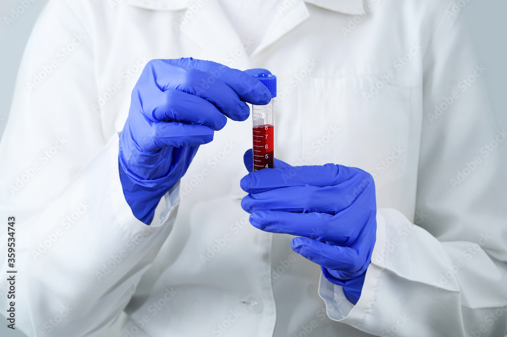 Laboratory doctor with close-up test tube of blood tests in hands white background. Laboratory doctor with close-up test tube of blood tests in hands white background.