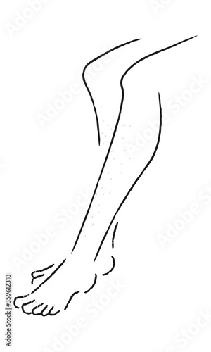 脚にむだ毛がある女性のイラスト。
