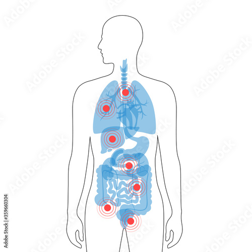 Pain in human body