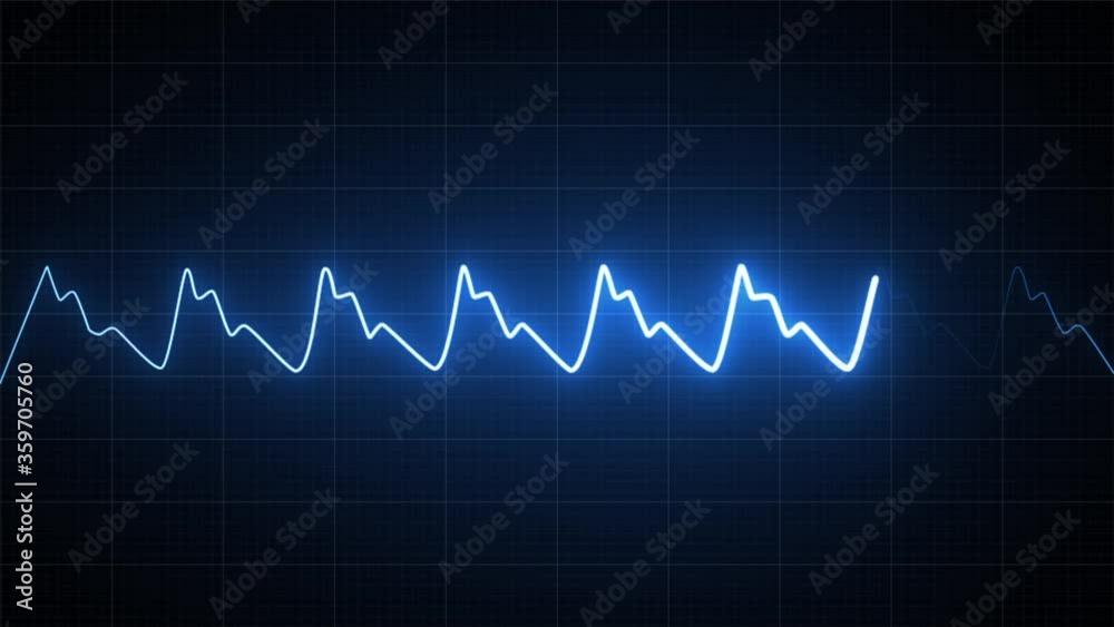 Heart Rate Monitor Electrocardiogram Ekg Or Ecg Looping background Heart Rate Monitor Electrocardiogram Ekg Or Ecg Looping background