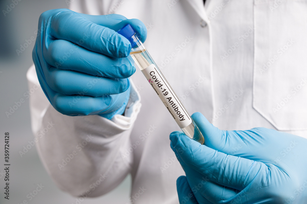 close up of hands in blue gloves holding a test tube after virus analysis with result markers close up of hands in blue gloves holding a test tube after virus analysis with result markers