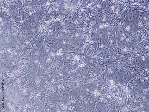 Mouse Cerebral Endothelial Cells (bEnd3 cells) were captured by Light Microscope (40x)