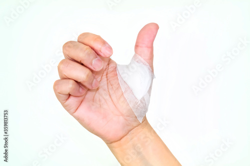 Hand injury