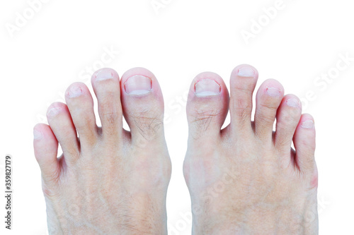 foot of asian man has good healthy