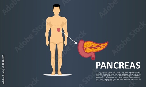Pancreas. Modern medical infographics. Internal organs in a human body. Anatomy of people vector Illustration 