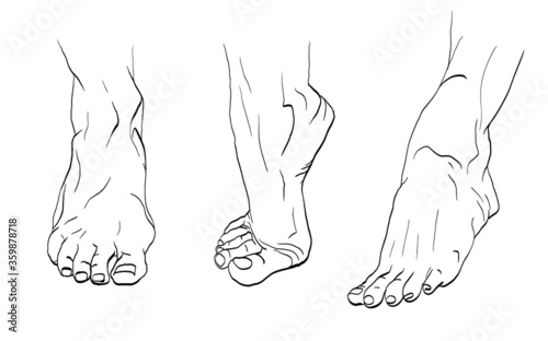 Feet drawn for podiatry problems. Fingers and nails to be restored for the podiatrist