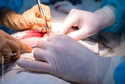 surgical suture. The hands of the surgeon and assistant in a sterile operating room impose a cosmetic suture on the skin of the patient s child.