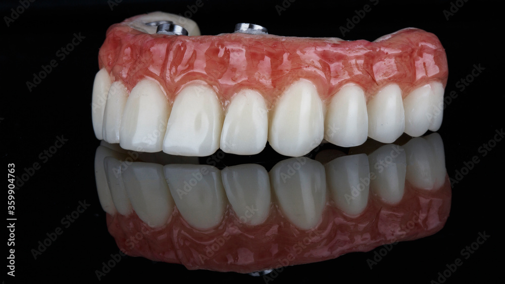 Obraz premium excellent prosthesis with artificial gum and anatomy, shot on a black background