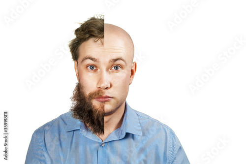 Man with half shaved beard and hair head. Guy before and after transplant and alopecia. Isolated on white background