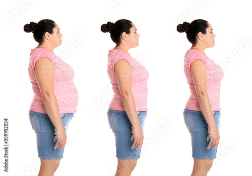 Collage with photos of overweight woman before and after weight loss on white background. Banner design