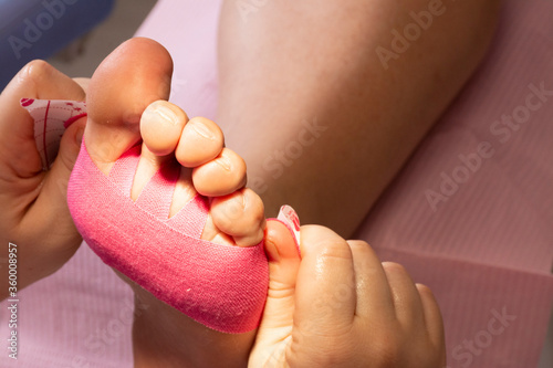 Placing a pink kinesio tape