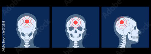 Skeleton x ray