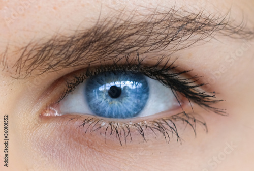 The woman's eyes, she has beautiful blue artificial eyes.