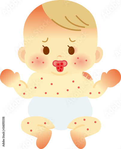 川崎病のおしめ姿の赤ちゃん　ベビー全身イラスト21