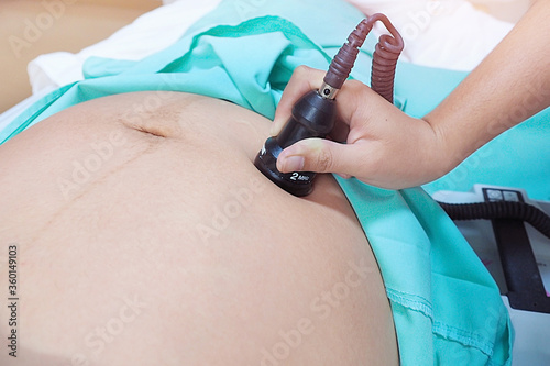 Close up shot photo of asian woman checking blood flow in placenta and uterus with Doppler fetal monitor during prenatal checkup by gynecologist before Caesarean section