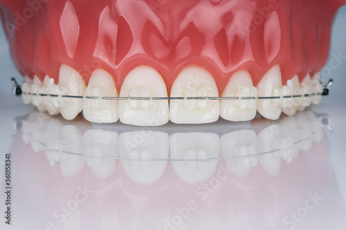 dental phantom model with upper jaw braces for demonstration to patients, shot on a white background with reflection