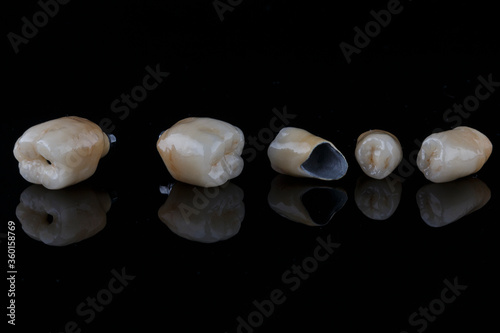 metal-ceramic dental crown on black glass with creative reflection