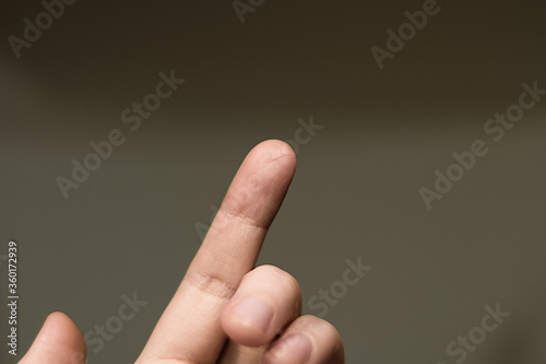 Фотография Human's hand with a small cut on fingertip