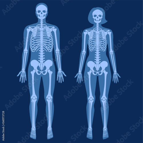 Skeleton x ray