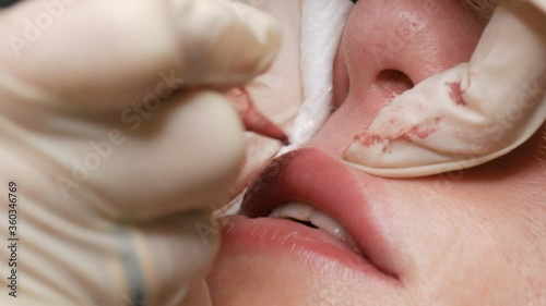 Wallpaper Mural Microblading lip tattoo with special coloring pigment that corrects lip color in cosmetology clinic. Hand makes permanent makeup lips procedure applying pigment makeup on lips with tattoo machine Torontodigital.ca