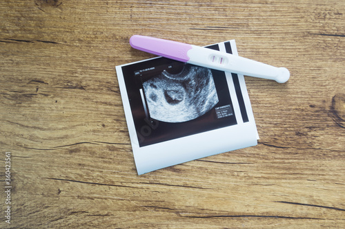 Positive pregnancy test and an ultrasound picture.