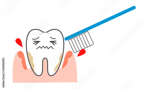 Periodontal disease bleeding toothpaste 　illustrations