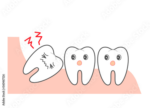  Wisdom tooth and alignment　orthodontic