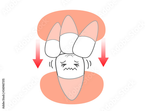 Dental alignment biased pressure chart correction character