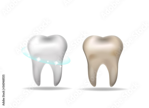 Teeth whitening concept. White tooth and yellow dirty realistic 3d style. Vector illustration