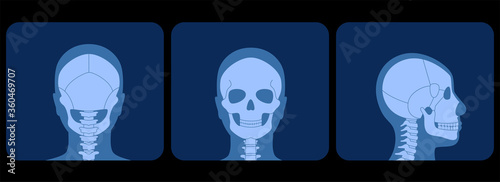 Skeleton x ray
