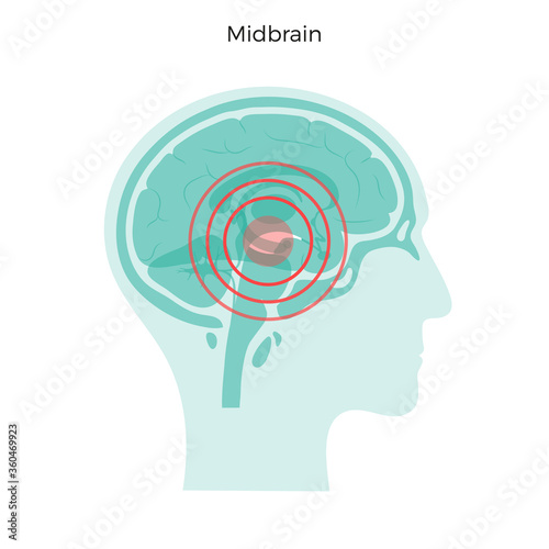 Pain Brain Illustration