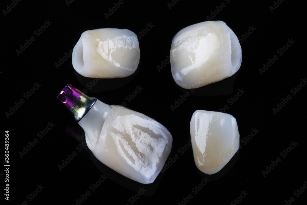 composition of dental crowns made of ceramics to replace the central teeth, shot on a black background composition of dental crowns made of ceramics to replace the central teeth, shot on a black background