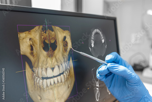 Dental consultation with 3D tomography image