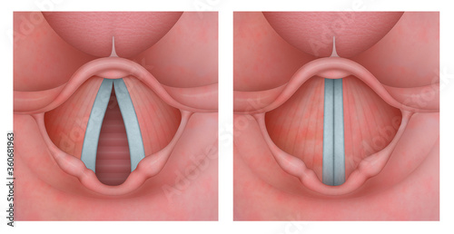 The larynx is an organ in the top of the neck of tetrapods involved in breathing, producing sound, and protecting the trachea against food aspiration