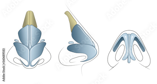The nasal cartilages are the septal, lateral, major alar, and minor alar cartilages