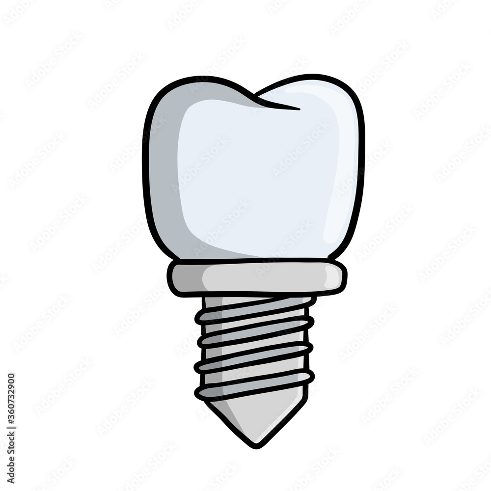 Tooth pin. White Dentist element. Operation for health. Doctor job. Color Cartoon illustration. Dental care and implant. Medical white part with the thread for the mouth Tooth pin. White Dentist element. Operation for health. Doctor job. Color Cartoon illustration. Dental care and implant. Medical white part with the thread for the mouth