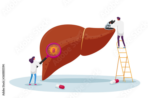 Doctor Characters in White Medical Robe Look in Electronic Microscope and Magnifier on Huge Diseased Liver. Hepatitis B Disease, Medical Analysis Research, Sickness, Cartoon People Vector Illustration
