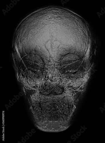 skull of a man