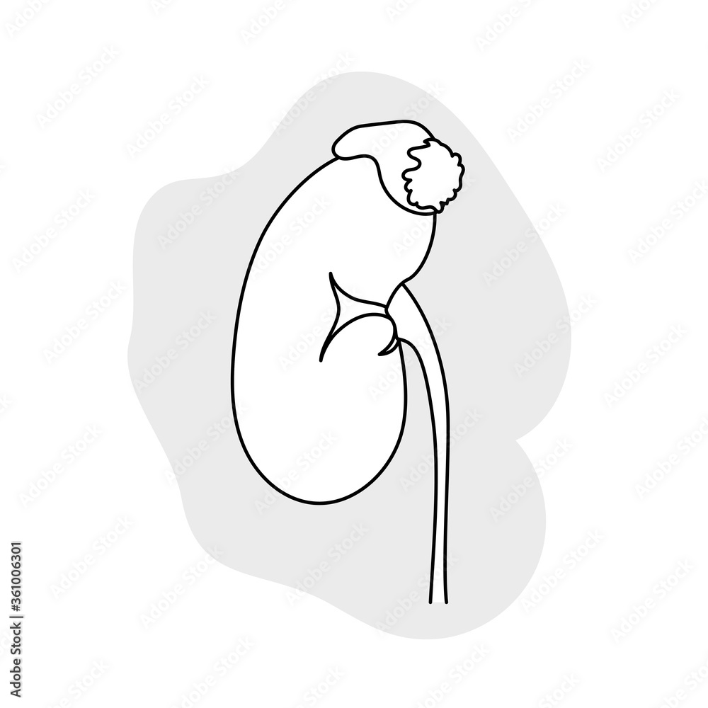 Adrenal gland tumor. Disease. Medical line art outline anatomy illustration.