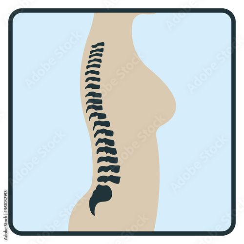 Spine backbone bone, x-ray concept icon, roentgen human body image isolated on white, flat vector illustration. Skeleton part of man organism.