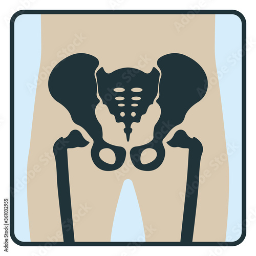 Pelvis bone, x-ray concept icon, roentgen human body image isolated on white, flat vector illustration. Skeleton part of man organism.