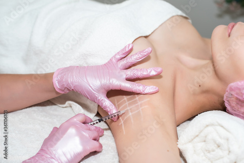Treatment of hyperhidrosis with Botox. in the cosmetologist’s office, female hands in pink gloves inject a young woman in the armpit. healthy body concept, self-care. stop sweating and bad smell photo