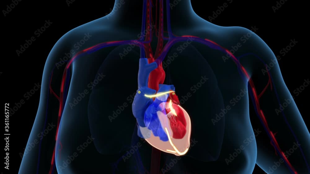 Irregular heartbeat (arrythmia) and atrial fibrillation of a human heart