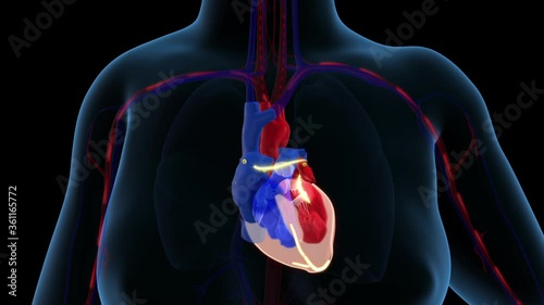 Irregular heartbeat (arrythmia) and atrial fibrillation of a human heart