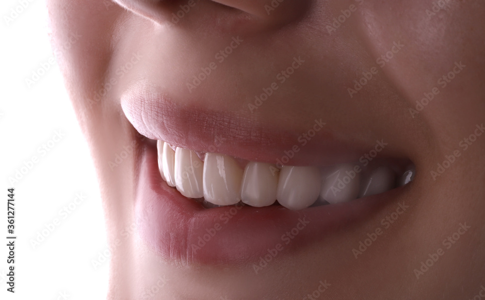 Obraz premium Perfect healthy teeth beautiful wide smile bleaching procedure whitening of young smiling attractive sexy lips woman. Dental restoration treatmentClose Up oral care dentistry, stomatology Dentistry