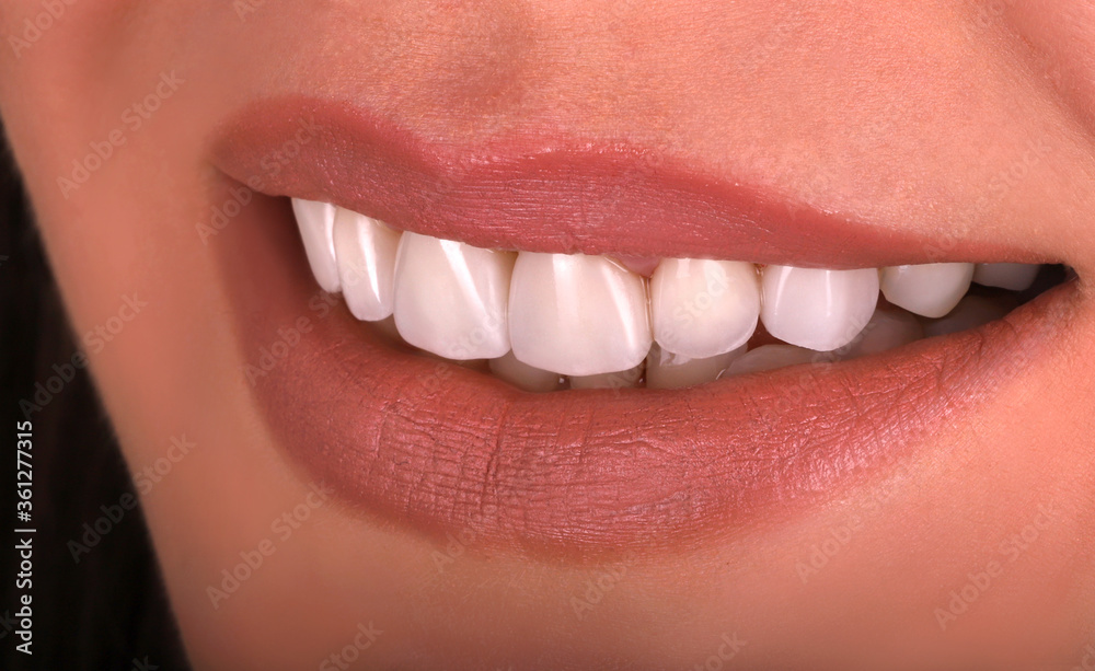 Obraz premium Perfect healthy teeth beautiful wide smile bleaching procedure whitening of young smiling attractive sexy lips woman. Dental restoration treatmentClose Up oral care dentistry, stomatology Dentistry