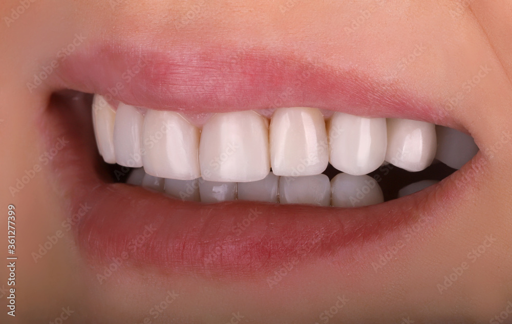 Obraz premium Perfect healthy teeth beautiful wide smile bleaching procedure whitening of young smiling attractive sexy lips woman. Dental restoration treatmentClose Up oral care dentistry, stomatology Dentistry