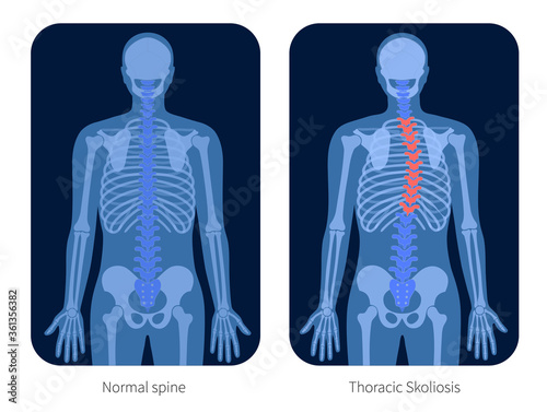 Skeleton x ray